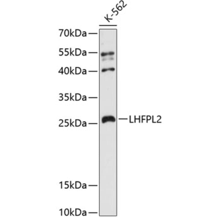 Western Blot - Anti-LHFPL2 Antibody (A88866) - Antibodies.com