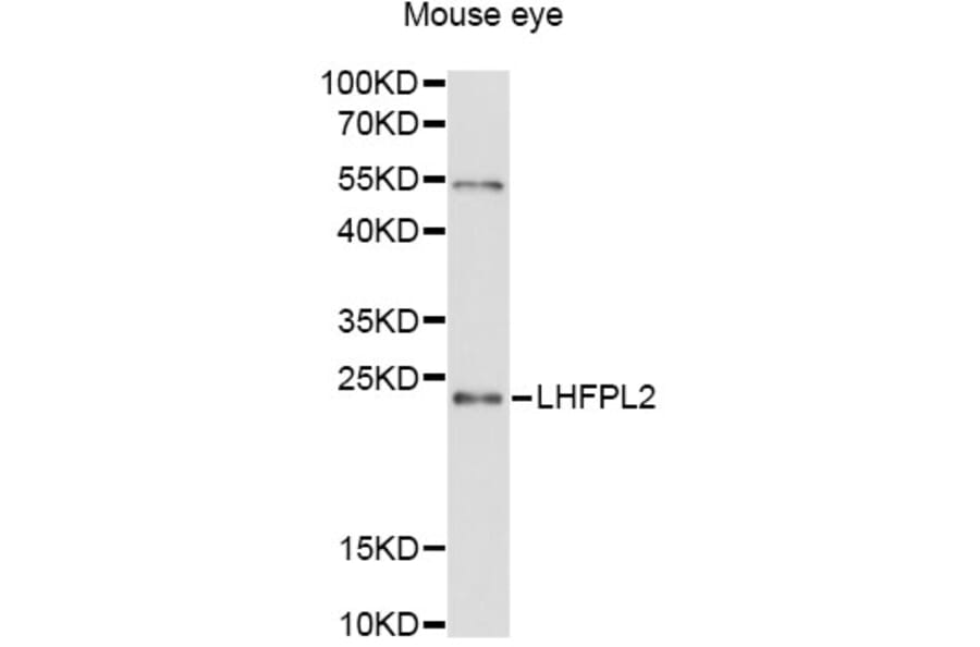 Western Blot - Anti-LHFPL2 Antibody (A12873) - Antibodies.com