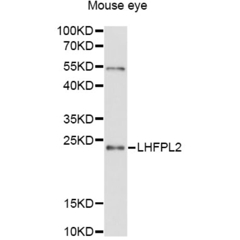 Western Blot - Anti-LHFPL2 Antibody (A12873) - Antibodies.com