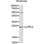Western Blot - Anti-LHFPL2 Antibody (A12873) - Antibodies.com