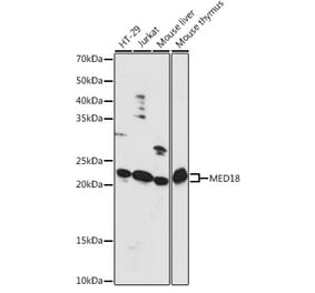 Western Blot - Anti-MED18 Antibody (A88868) - Antibodies.com