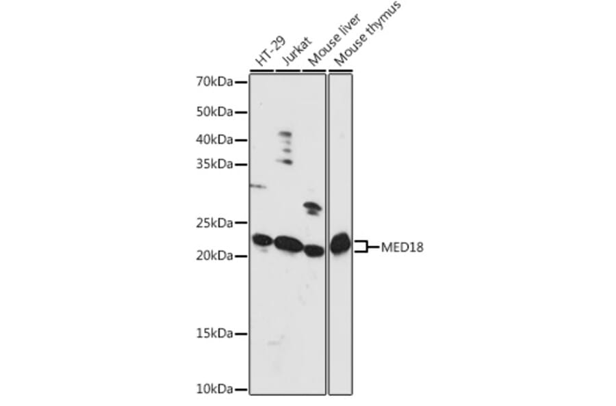 Western Blot - Anti-MED18 Antibody (A88868) - Antibodies.com