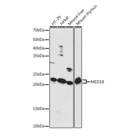 Western Blot - Anti-MED18 Antibody (A88868) - Antibodies.com