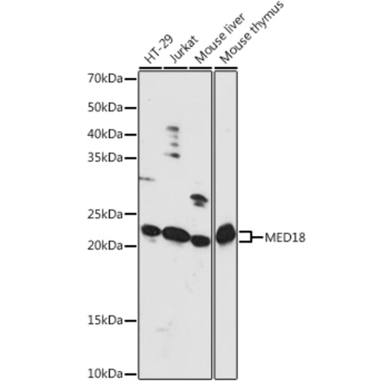 Western Blot - Anti-MED18 Antibody (A88868) - Antibodies.com