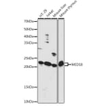 Western Blot - Anti-MED18 Antibody (A88868) - Antibodies.com