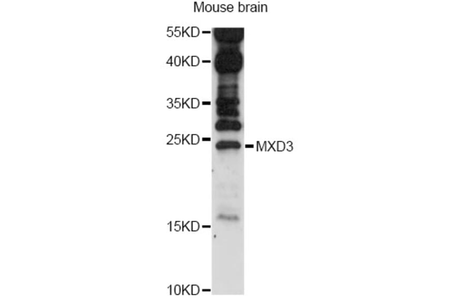 Western Blot - Anti-MXD3 Antibody (A14631) - Antibodies.com