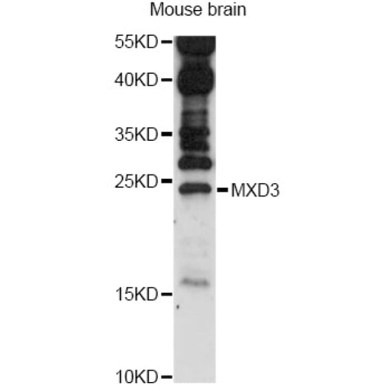 Western Blot - Anti-MXD3 Antibody (A14631) - Antibodies.com