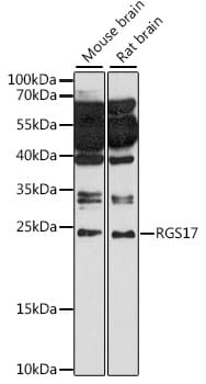 Western blot analysis of extracts of various cell lines, using Anti-RGS17 Antibody (A15815) at 1:1,000 dilution.
Secondary antibody: Goat Anti-Rabbit IgG (H+L) (HRP) (AS014) at 1:10,000 dilution.
Lysates / proteins: 25µg per lane.
Blocking buffer: 3% non-fat dry milk in TBST.
Detection: ECL Basic Kit (RM00020).
Exposure time: 90s.