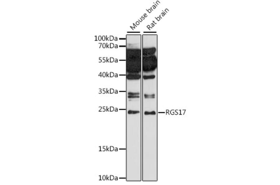 Western Blot - Anti-RGS17/RGSZ2 Antibody (A88870) - Antibodies.com