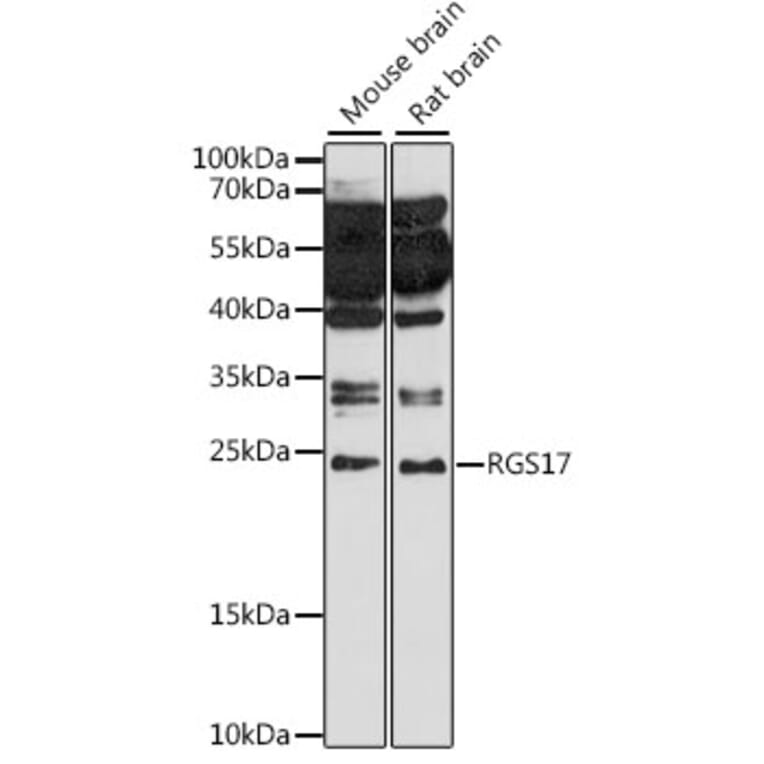 Western Blot - Anti-RGS17/RGSZ2 Antibody (A88870) - Antibodies.com