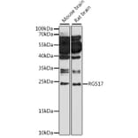 Western Blot - Anti-RGS17/RGSZ2 Antibody (A88870) - Antibodies.com