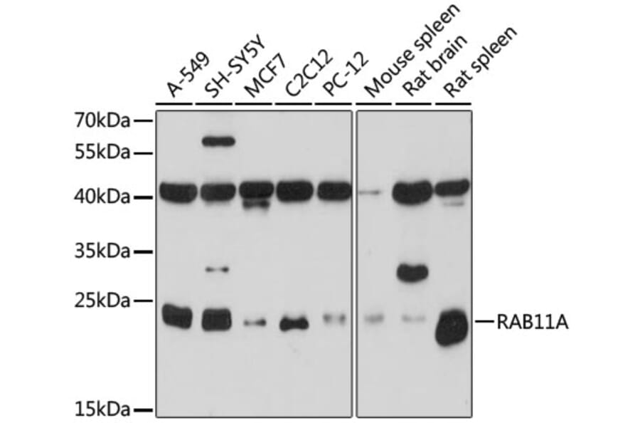 Western Blot - Anti-RAB11A Antibody (A17031) - Antibodies.com