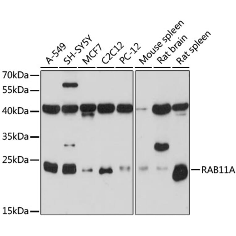 Western Blot - Anti-RAB11A Antibody (A17031) - Antibodies.com