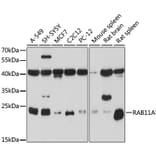 Western Blot - Anti-RAB11A Antibody (A17031) - Antibodies.com