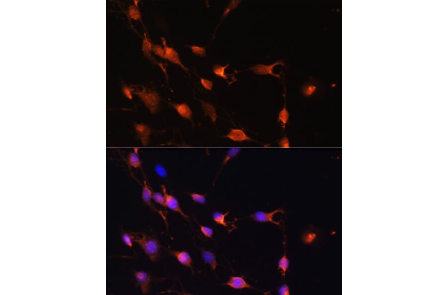 Immunofluorescence - Anti-RAB11A Antibody (A17031) - Antibodies.com
