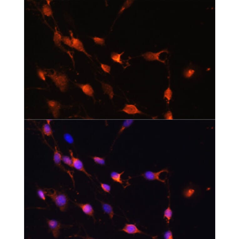 Immunofluorescence - Anti-RAB11A Antibody (A17031) - Antibodies.com