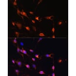 Immunofluorescence - Anti-RAB11A Antibody (A17031) - Antibodies.com