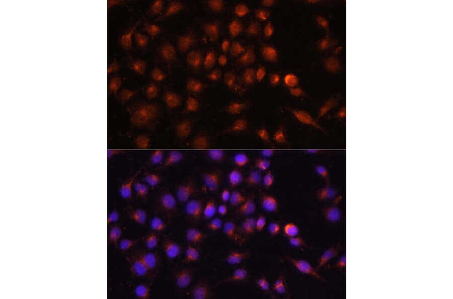 Immunofluorescence - Anti-RAB11A Antibody (A17031) - Antibodies.com