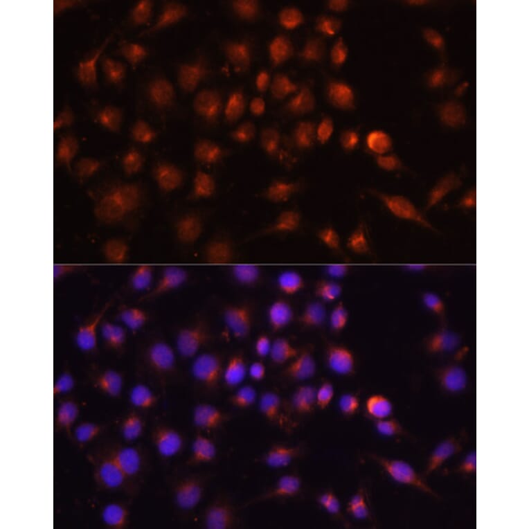 Immunofluorescence - Anti-RAB11A Antibody (A17031) - Antibodies.com