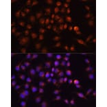 Immunofluorescence - Anti-RAB11A Antibody (A17031) - Antibodies.com