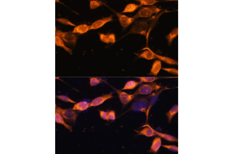 Immunofluorescence - Anti-RAB11A Antibody (A17031) - Antibodies.com
