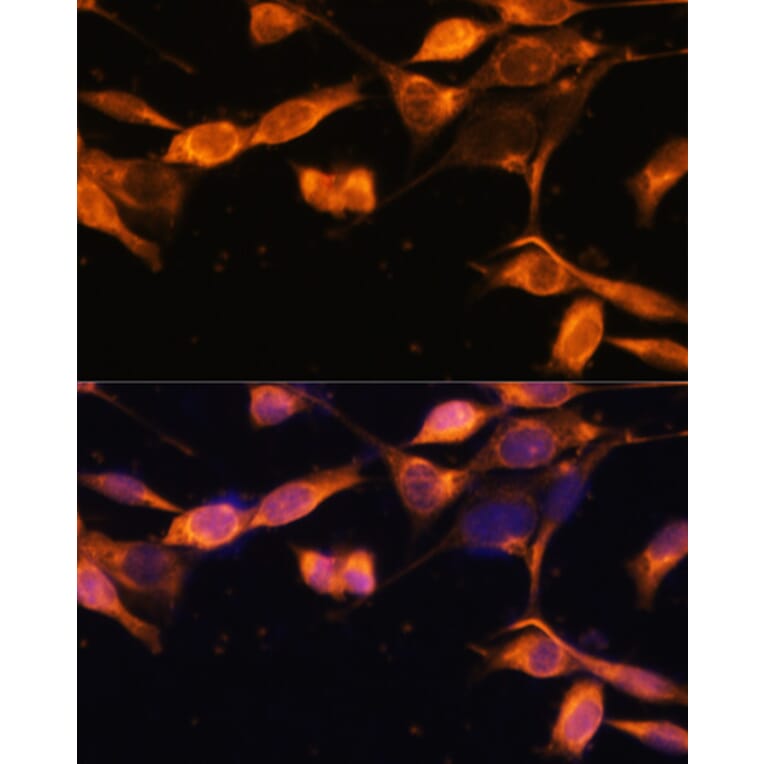 Immunofluorescence - Anti-RAB11A Antibody (A17031) - Antibodies.com