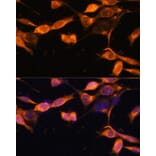 Immunofluorescence - Anti-RAB11A Antibody (A17031) - Antibodies.com