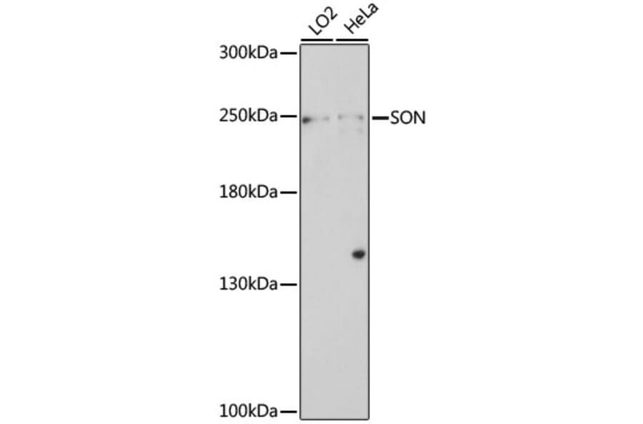 Western Blot - Anti-SON/DBP5 Antibody (A88873) - Antibodies.com