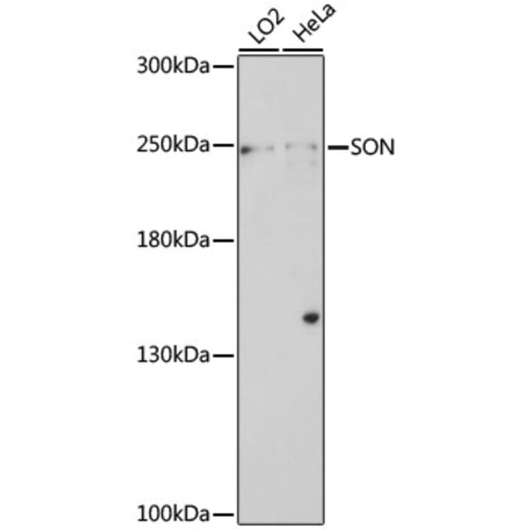 Western Blot - Anti-SON/DBP5 Antibody (A88873) - Antibodies.com