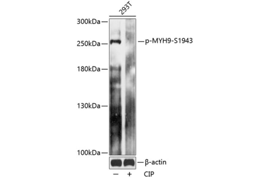 Western Blot - Anti-non-muscle Myosin IIA (phospho Ser1943) Antibody (A88874) - Antibodies.com