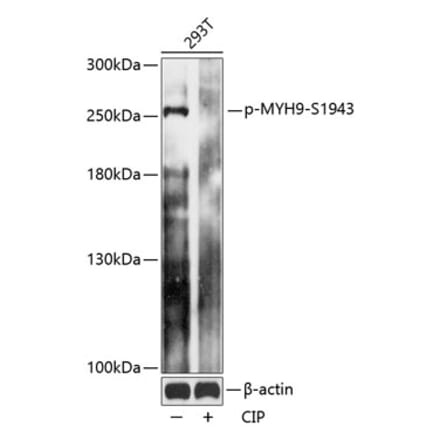 Western Blot - Anti-non-muscle Myosin IIA (phospho Ser1943) Antibody (A88874) - Antibodies.com