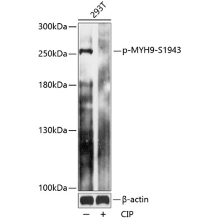 Western Blot - Anti-non-muscle Myosin IIA (phospho Ser1943) Antibody (A88874) - Antibodies.com