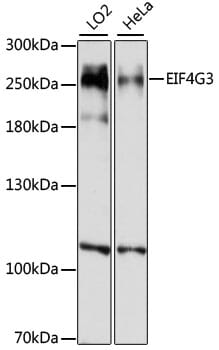 Western blot analysis of extracts of various cell lines, using Anti-EIF4G3 Antibody (A14621) at 1:1,000 dilution.
Secondary antibody: Goat Anti-Rabbit IgG (H+L) (HRP) (AS014) at 1:10,000 dilution.
Lysates / proteins: 25µg per lane.
Blocking buffer: 3% non-fat dry milk in TBST.
Detection: ECL Basic Kit (RM00020).
Exposure time: 30s.