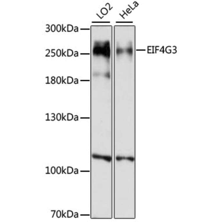 Western Blot - Anti-eIF4GII Antibody (A88875) - Antibodies.com