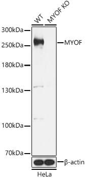Western blot analysis of extracts of various cell lines, using Anti-MYOF Antibody (A15427) at 1:1,000 dilution.
Secondary antibody: Goat Anti-Rabbit IgG (H+L) (HRP) (AS014) at 1:10,000 dilution.
Lysates / proteins: 25µg per lane.
Blocking buffer: 3% non-fat dry milk in TBST.
Detection: ECL Basic Kit (RM00020).
Exposure time: 2s.