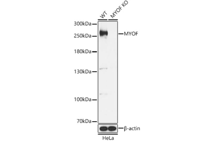 Western Blot - Anti-Myoferlin Antibody (A88876) - Antibodies.com