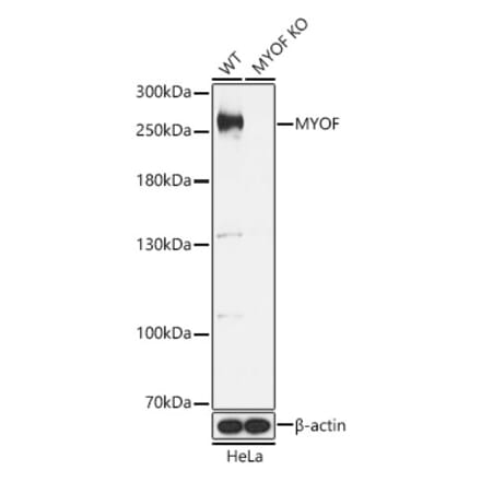 Western Blot - Anti-Myoferlin Antibody (A88876) - Antibodies.com