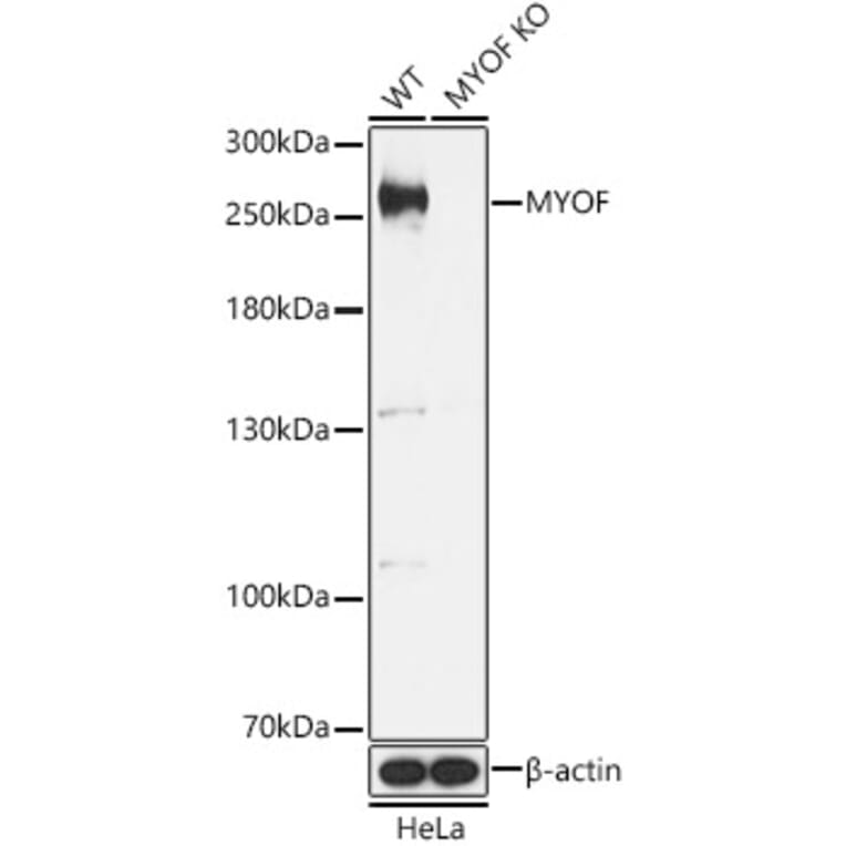 Western Blot - Anti-Myoferlin Antibody (A88876) - Antibodies.com