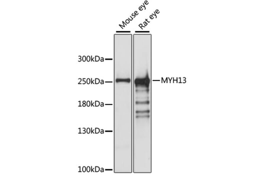 Western Blot - Anti-MYH13 Antibody (A88877) - Antibodies.com