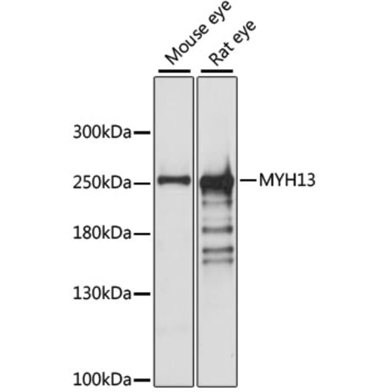 Western Blot - Anti-MYH13 Antibody (A88877) - Antibodies.com