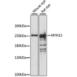 Western Blot - Anti-MYH13 Antibody (A88877) - Antibodies.com