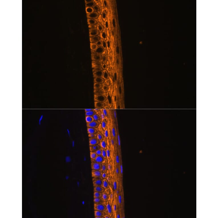 Immunofluorescence - Anti-MYH13 Antibody (A88877) - Antibodies.com