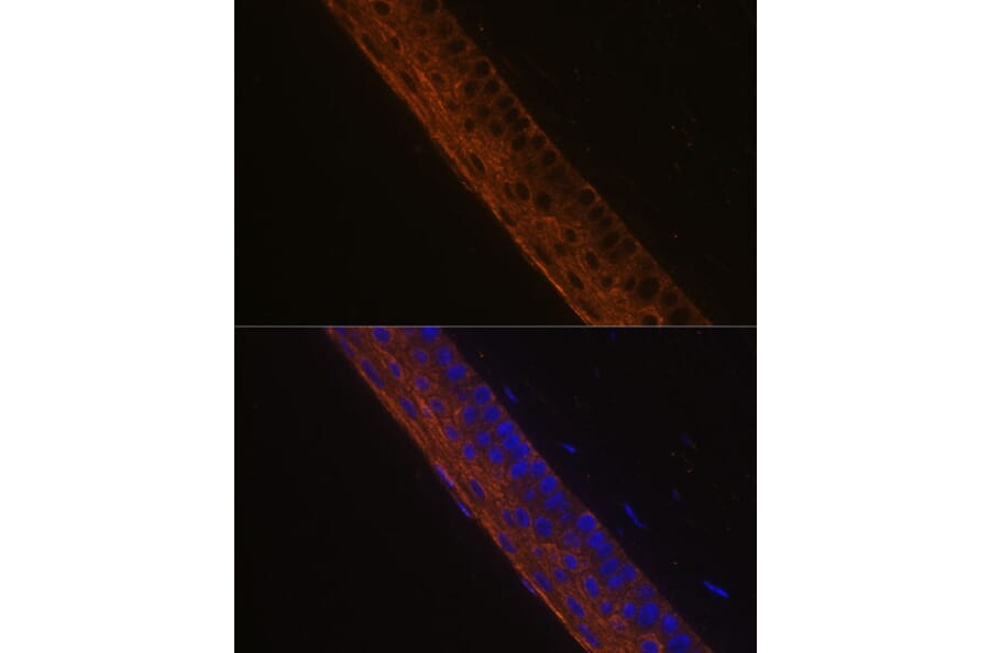 Immunofluorescence - Anti-MYH13 Antibody (A88877) - Antibodies.com