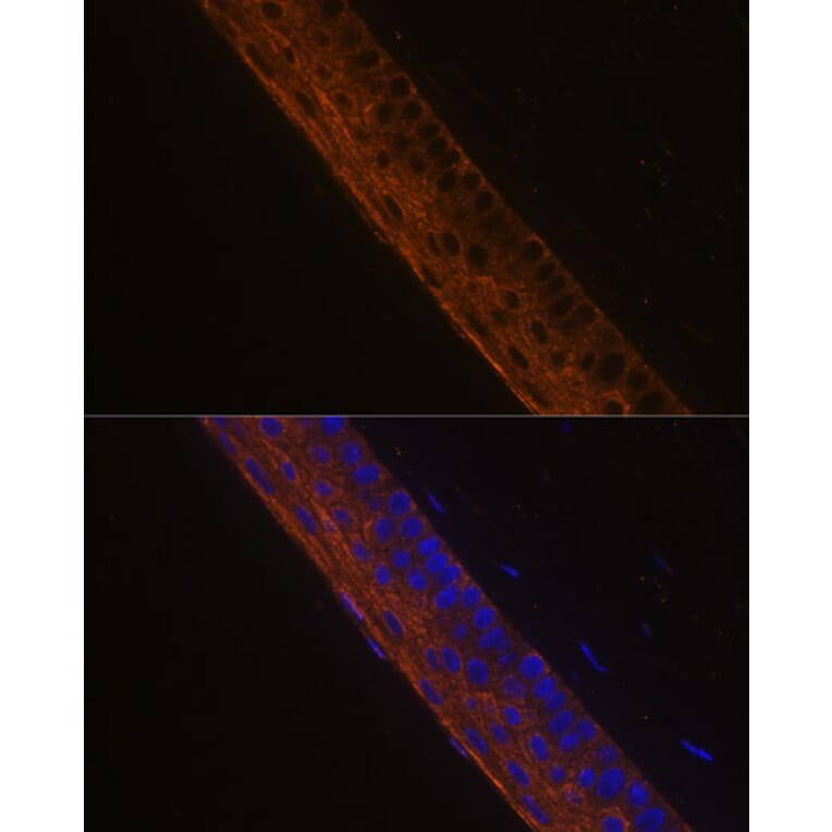 Immunofluorescence - Anti-MYH13 Antibody (A88877) - Antibodies.com