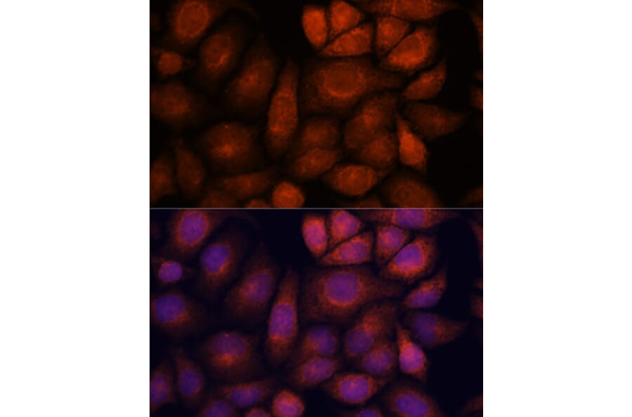 Immunofluorescence - Anti-KIF13A Antibody (A88878) - Antibodies.com
