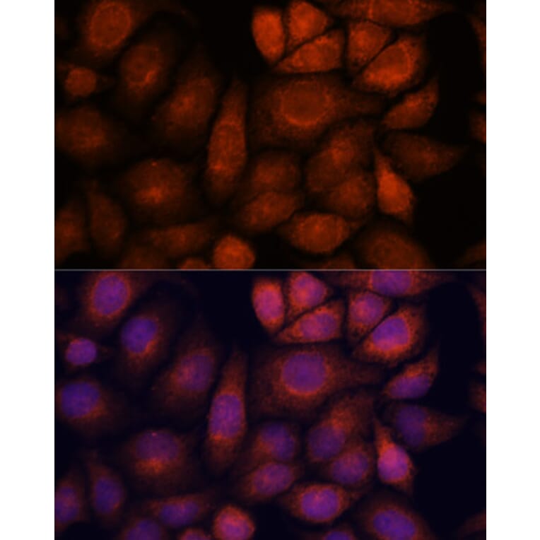 Immunofluorescence - Anti-KIF13A Antibody (A88878) - Antibodies.com
