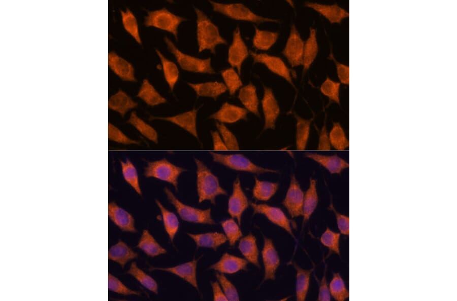 Immunofluorescence - Anti-KIF13A Antibody (A88878) - Antibodies.com