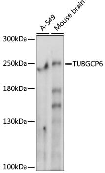 Western blot analysis of extracts of various cell lines, using Anti-TUBGCP6 Antibody (A15921) at 1000 dilution.
Secondary antibody: Goat Anti-Rabbit IgG (H+L) (HRP) (AS014) at 1:10,000 dilution.
Lysates / proteins: 25µg per lane.
Blocking buffer: 3% non-fat dry milk in TBST.
Detection: ECL Basic Kit (RM00020).
Exposure time: 10s.