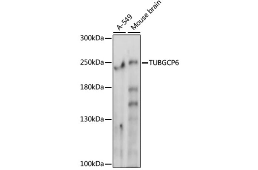 Western Blot - Anti-GCP6 Antibody (A88879) - Antibodies.com