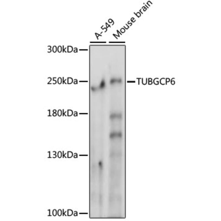 Western Blot - Anti-GCP6 Antibody (A88879) - Antibodies.com